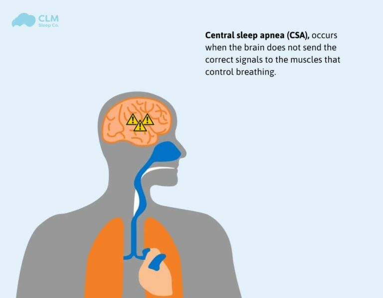 Central sleep apnea (CSA): Symptoms, Causes and Treatment