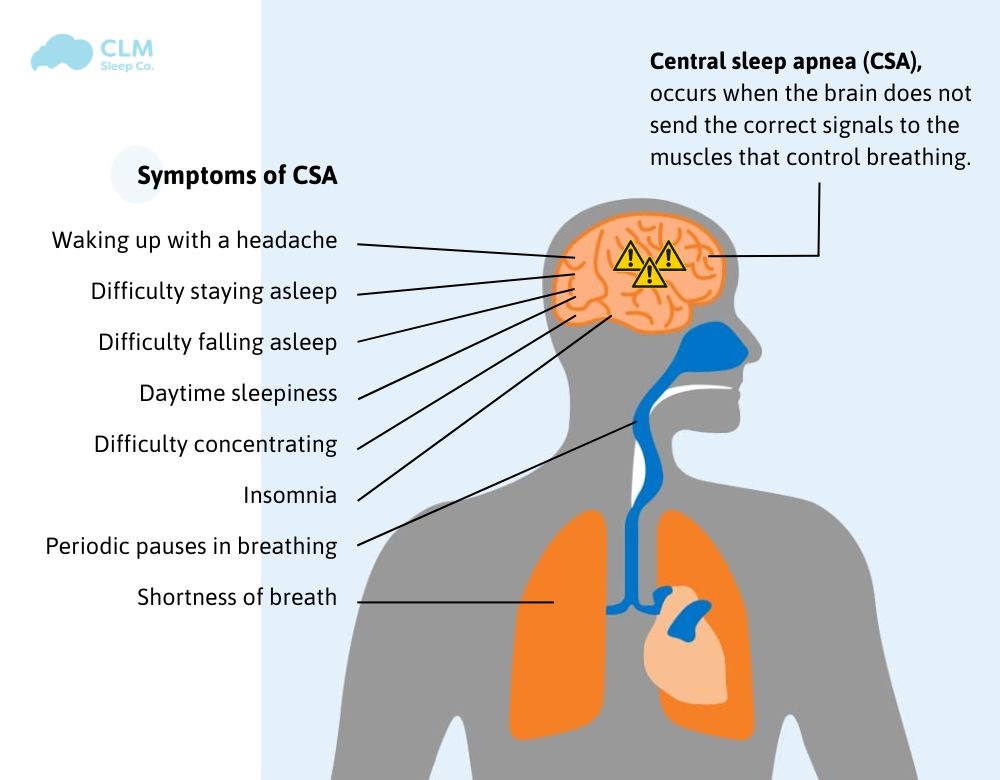 Central sleep apnea (CSA)