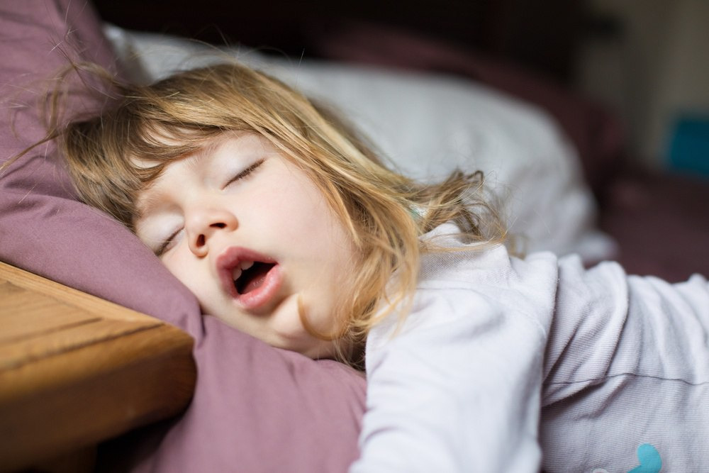 Signs of sleep apnea in children: Hyperactivity or Poor School Performance, Loud Snoring, Bedwetting,...  