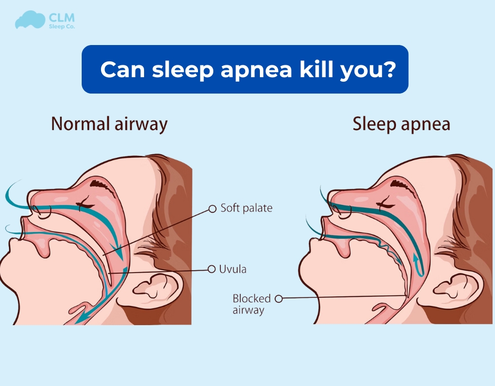 Can Sleep Apnea Kill You? Understanding the Risks and Consequences