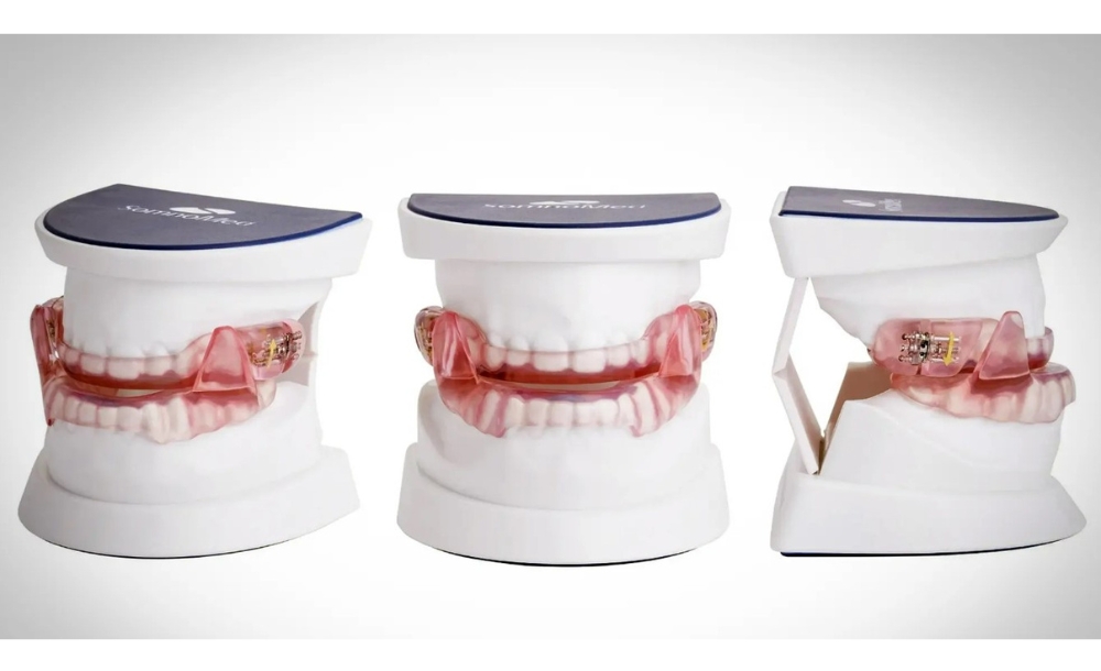 A sleep guardian is a dental device designed to keep the airway open during sleep