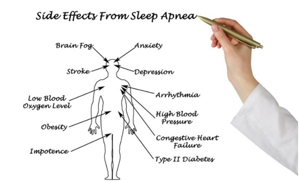 Impact of Sleep Apnea