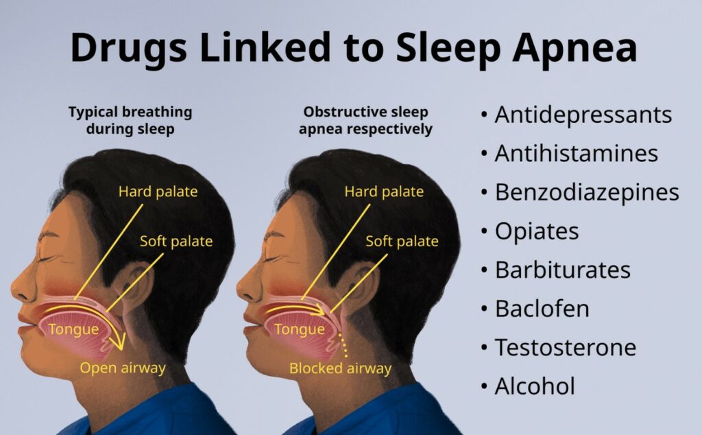 Alcohol and Medication Use also cause snoring