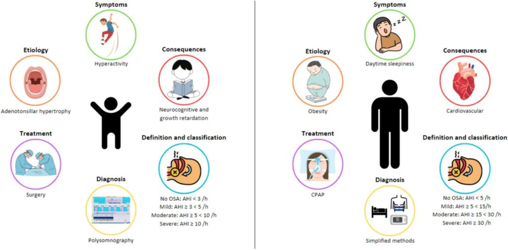 Sleep apnea in children has different symptoms than in adults