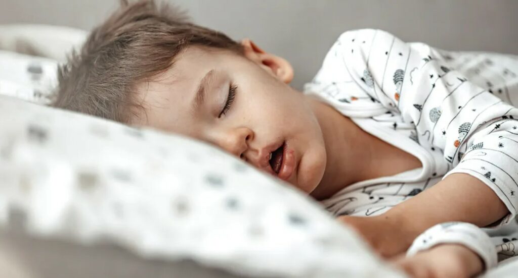 Which causes pediatric obstructive sleep apnea?