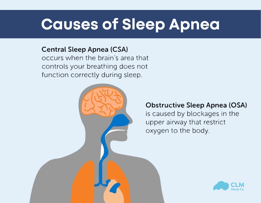 Sleep apnea is caused by health conditions, lifestyle choices and genetics