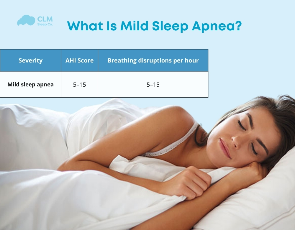 Mild sleep apnea is a type of OSA with 5 to 15 breathing interruptions per hour of sleep