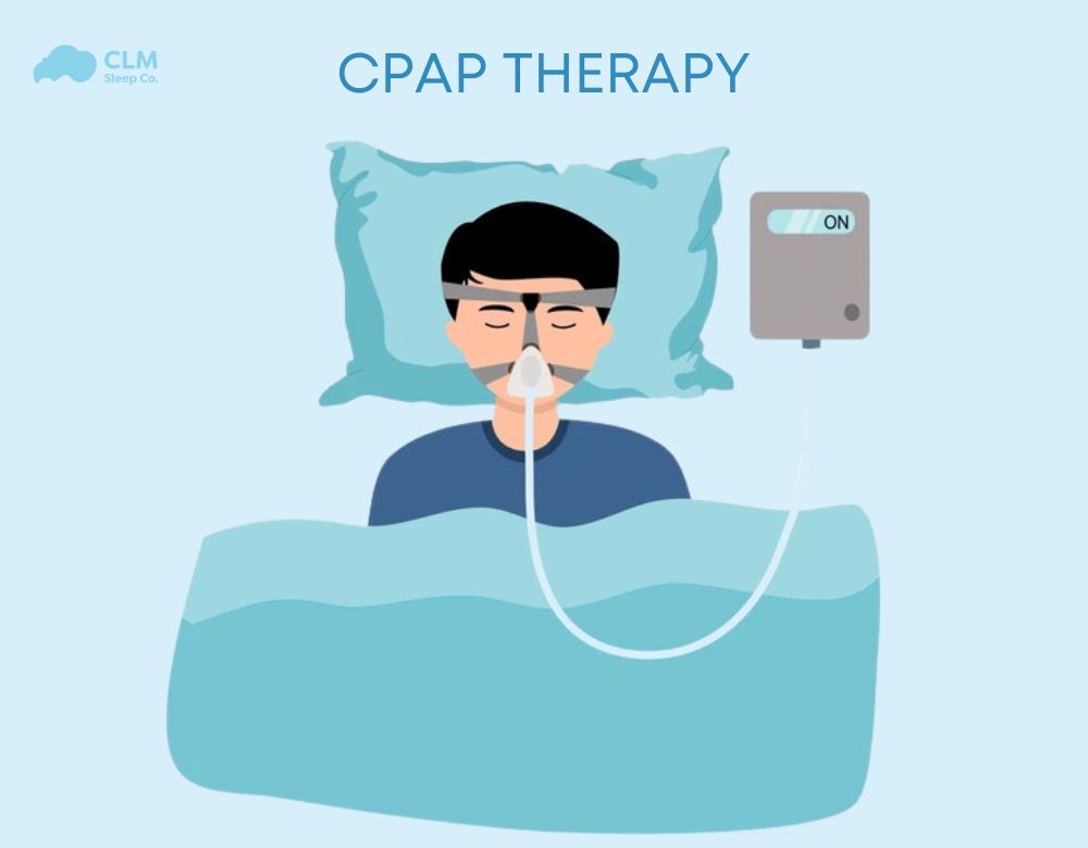 Continuous Positive Airway Pressure (CPAP)