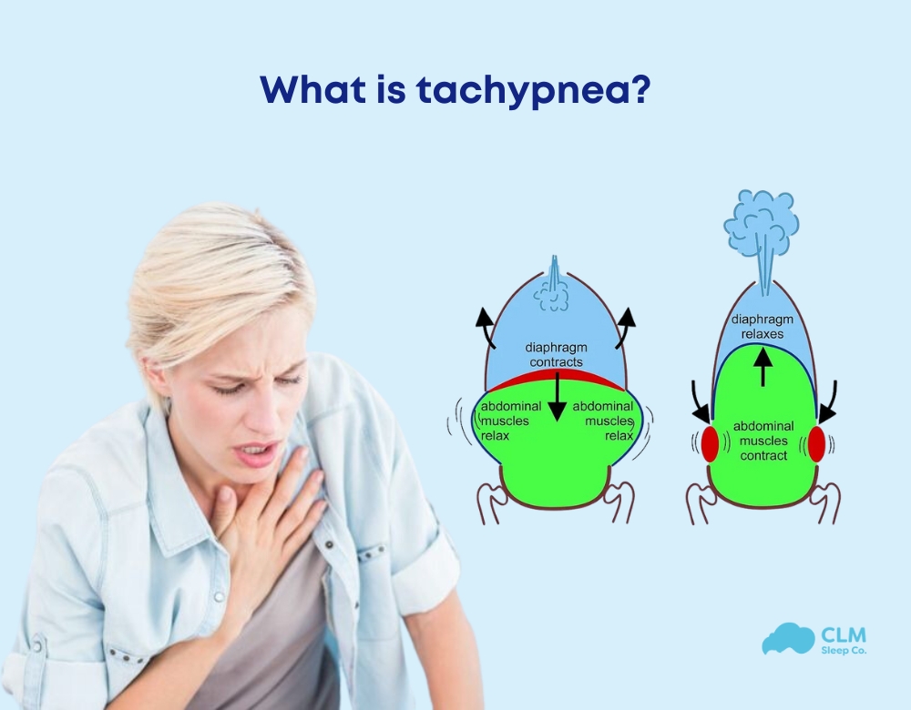 What is the definition of tachypnea?