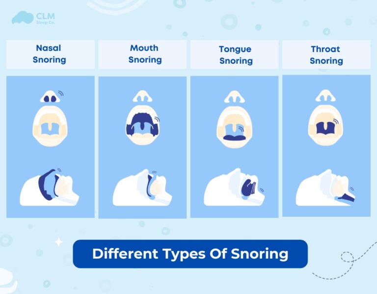 How to Identify and Treat Different Types of Snoring