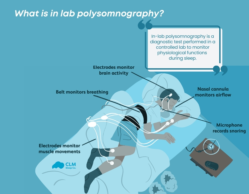 What can a sleep study diagnose?