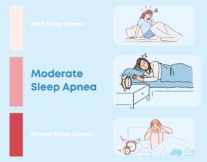 Moderate Sleep Apnea