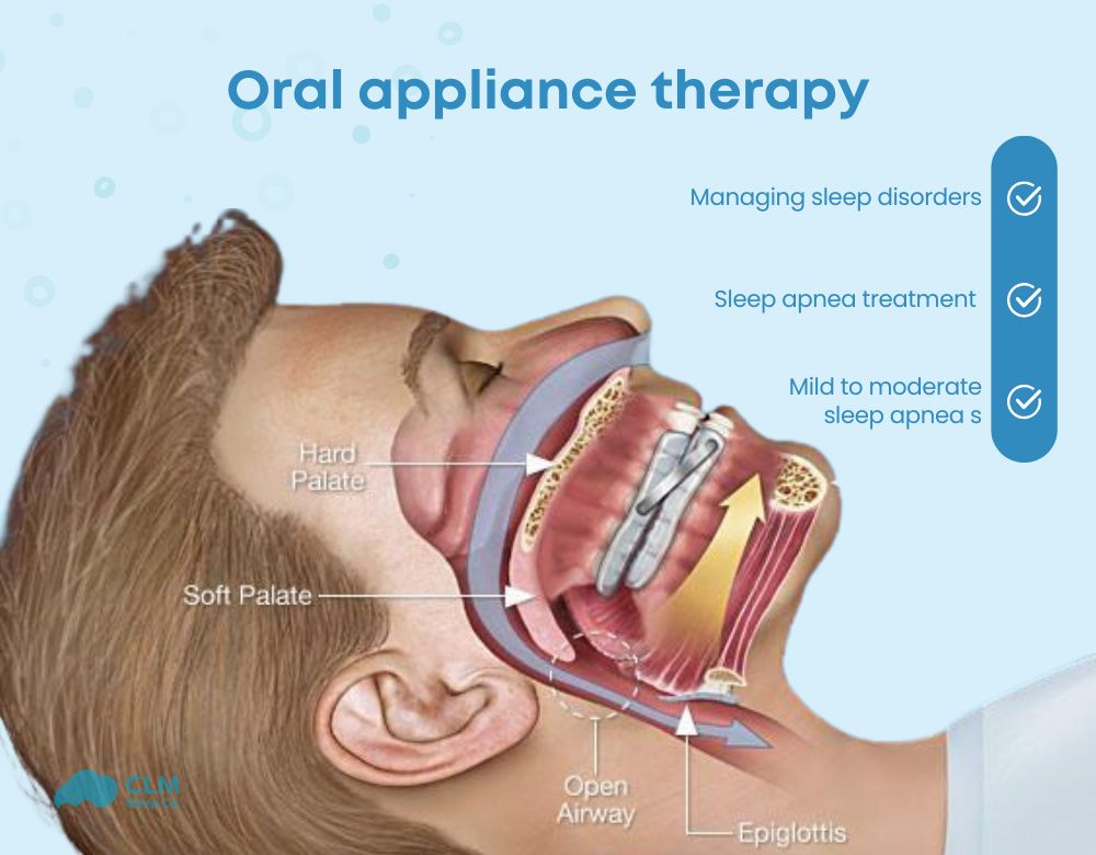 Oral Appliance Therapy