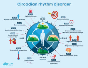 circadian rhythm disorder