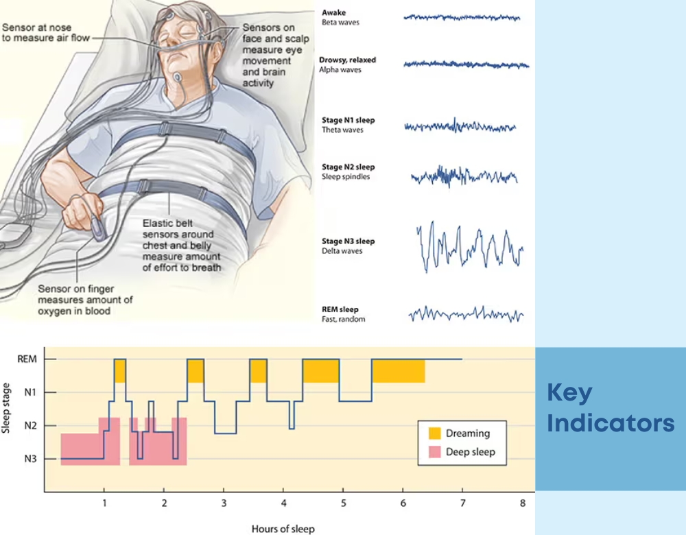 Key Indicators in Results from Sleep Study