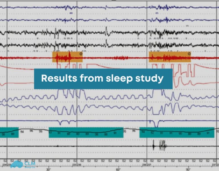 results from sleep study